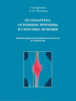 cover image of Остеоартроз. Основные причины и способы лечения